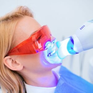 LED lámpás fogfehérítés a Hollán Dentnél